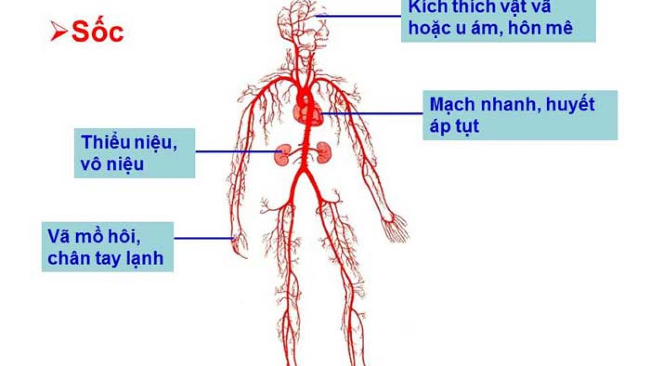 SỐC GIẢM THỂ TÍCH MÁU