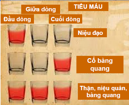 CHẨN ĐOÁN VÀ XỬ TRÍ ĐÁI MÁU