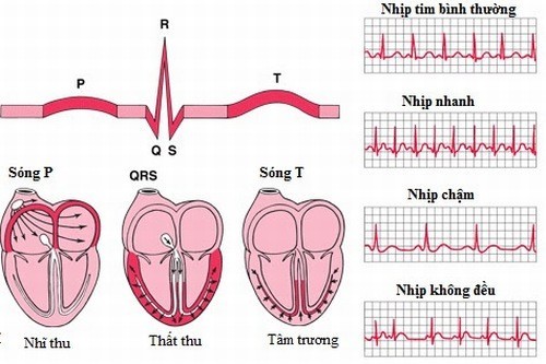 CHẨN ĐOÁN VÀ ĐIỀU TRỊ CÁC LOẠN NHỊP TIM CHẬM