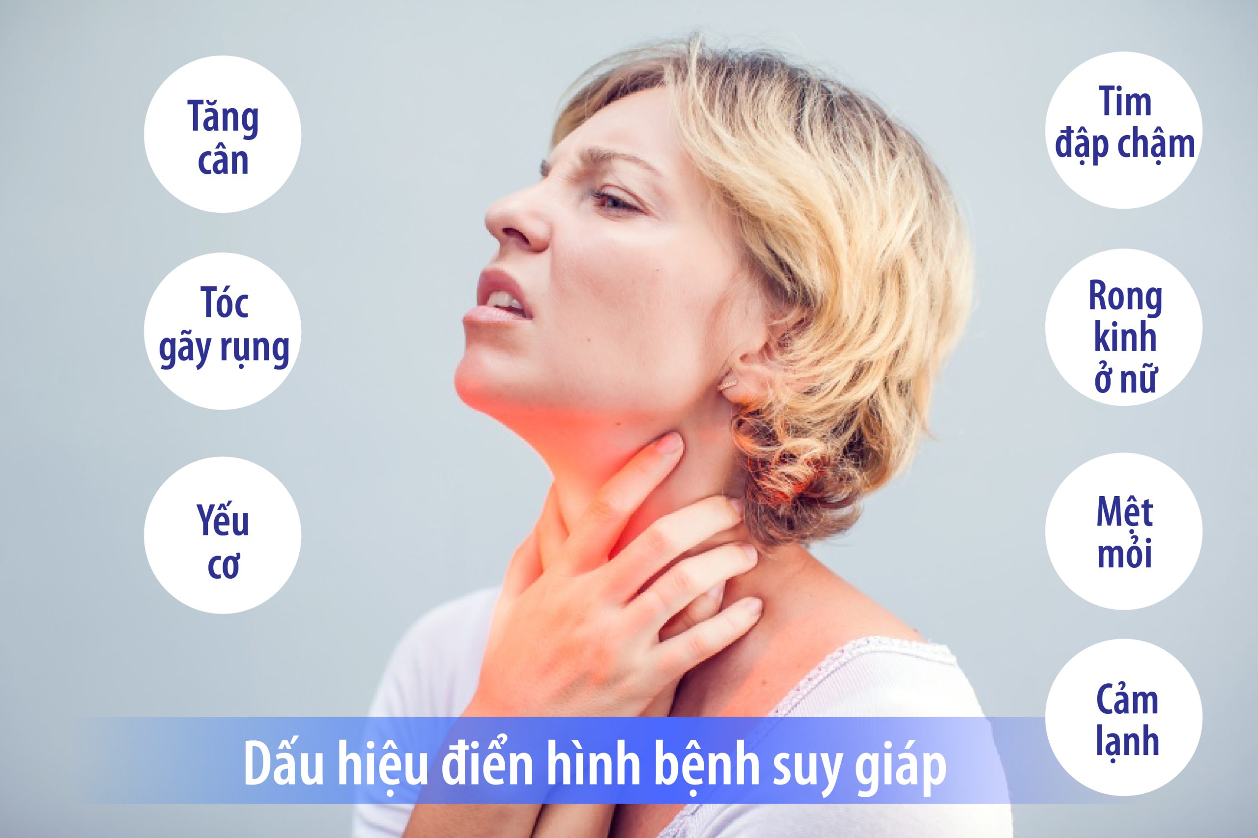 HÔN MÊ DO SUY CHỨC NĂNG TUYẾN GIÁP