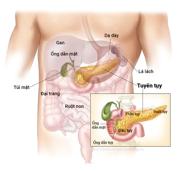 VIÊM TỤY CẤP NẶNG